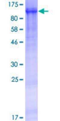 SDS-PAGE Recombinant Human WWC2 GST (N-Term) Protein