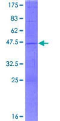 12.5% SDS-PAGE Stained with Coomassie Blue.