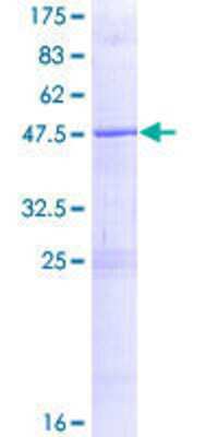 Other Recombinant Human ZNF614 GST (N-Term) Protein