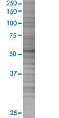 TRIM46 transfected lysate.