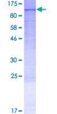 12.5% SDS-PAGE Stained with Coomassie Blue.