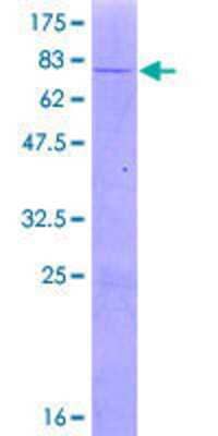 12.5% SDS-PAGE Stained with Coomassie Blue.