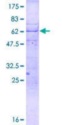 12.5% SDS-PAGE Stained with Coomassie Blue.