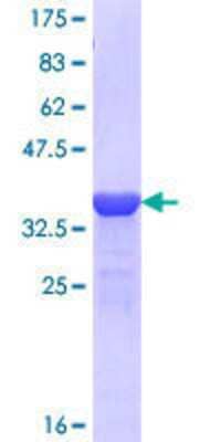 12.5% SDS-PAGE Stained with Coomassie Blue.