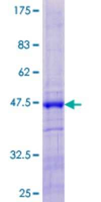 12.5% SDS-PAGE Stained with Coomassie Blue.