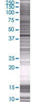 SPG11 transfected lysate.