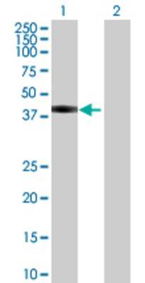 Lane 1: SPG11 transfected lysate (46.86 KDa) Lane 2: Non-transfected lysate.