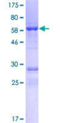 12.5% SDS-PAGE Stained with Coomassie Blue.