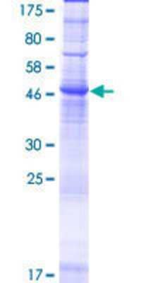 12.5% SDS-PAGE Stained with Coomassie Blue.