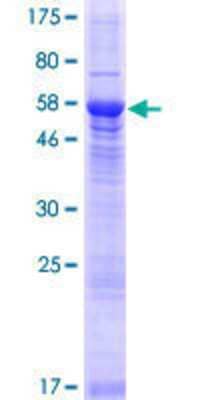 12.5% SDS-PAGE Stained with Coomassie Blue.