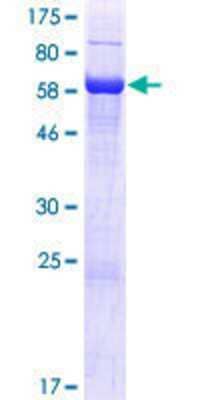 12.5% SDS-PAGE Stained with Coomassie Blue.