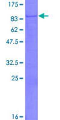 12.5% SDS-PAGE Stained with Coomassie Blue.