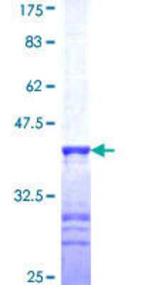 12.5% SDS-PAGE Stained with Coomassie Blue.