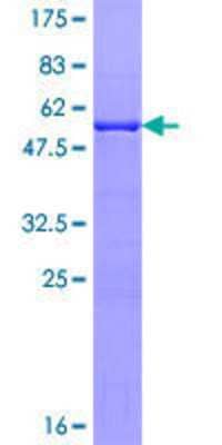 12.5% SDS-PAGE Stained with Coomassie Blue.