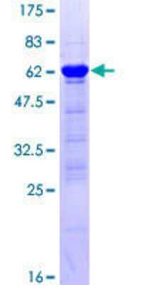 12.5% SDS-PAGE Stained with Coomassie Blue.