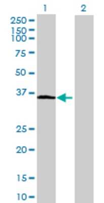 Lane 1: ABTB1 transfected lysate (37.07 KDa) Lane 2: Non-transfected lysate.