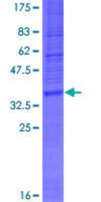 12.5% SDS-PAGE Stained with Coomassie Blue.