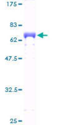 12.5% SDS-PAGE Stained with Coomassie Blue.