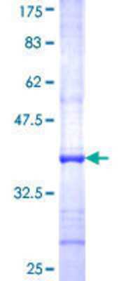 12.5% SDS-PAGE Stained with Coomassie Blue.