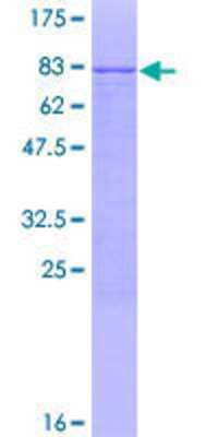 12.5% SDS-PAGE Stained with Coomassie Blue.