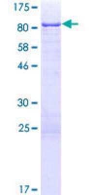 12.5% SDS-PAGE Stained with Coomassie Blue.