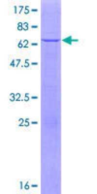 Recombinant Human APOL6 Protein [H00080830-P01] - 12.5% SDS-PAGE Stained with Coomassie Blue.