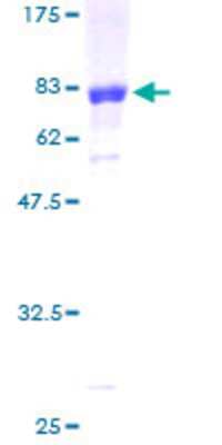 12.5% SDS-PAGE Stained with Coomassie Blue.