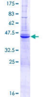 12.5% SDS-PAGE Stained with Coomassie Blue.