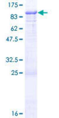 12.5% SDS-PAGE Stained with Coomassie Blue.
