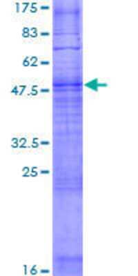12.5% SDS-PAGE Stained with Coomassie Blue.
