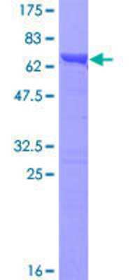 Other Recombinant Human TXNDC5 GST (N-Term) Protein