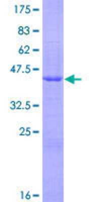 12.5% SDS-PAGE Stained with Coomassie Blue.