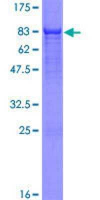 12.5% SDS-PAGE Stained with Coomassie Blue.