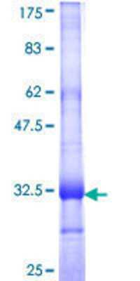 12.5% SDS-PAGE Stained with Coomassie Blue.