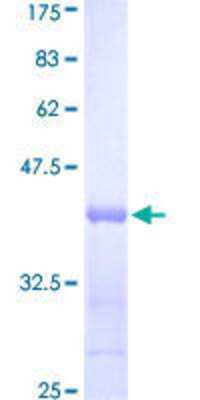 12.5% SDS-PAGE Stained with Coomassie Blue.