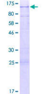12.5% SDS-PAGE Stained with Coomassie Blue.