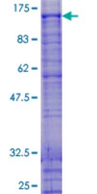 12.5% SDS-PAGE Stained with Coomassie Blue.