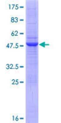 Other Recombinant Human RNF170 GST (N-Term) Protein