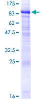 12.5% SDS-PAGE Stained with Coomassie Blue.