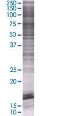 NETO1 transfected lysate.