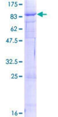 Recombinant Human Vang-like Protein 1/VANGL1 Protein [H00081839-P01] - 12.5% SDS-PAGE Stained with Coomassie Blue.