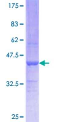 12.5% SDS-PAGE Stained with Coomassie Blue.