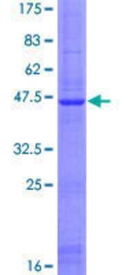 12.5% SDS-PAGE Stained with Coomassie Blue.