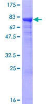 12.5% SDS-PAGE Stained with Coomassie Blue.