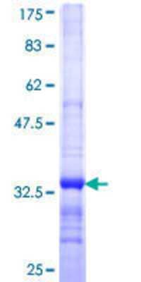 SDS-Page: Recombinant Human ADPGK Protein [H00083440-Q01] - 12.5% SDS-PAGE Stained with Coomassie Blue.