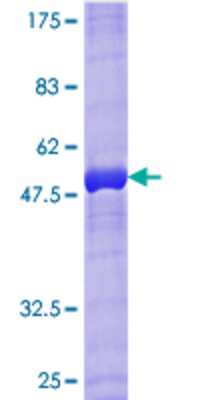12.5% SDS-PAGE Stained with Coomassie Blue.
