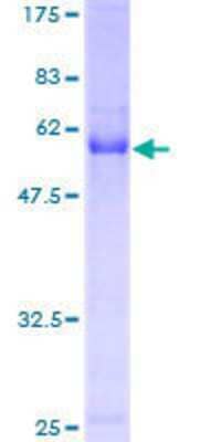 12.5% SDS-PAGE Stained with Coomassie Blue.