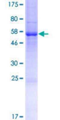 Other Recombinant Human RTBDN GST (N-Term) Protein