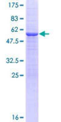 12.5% SDS-PAGE Stained with Coomassie Blue.