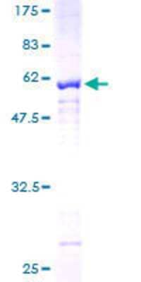 Other Recombinant Human AKR1CL2 GST (N-Term) Protein